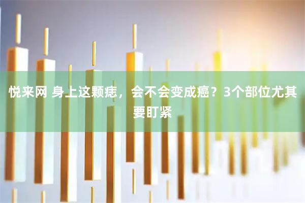 悦来网 身上这颗痣，会不会变成癌？3个部位尤其要盯紧